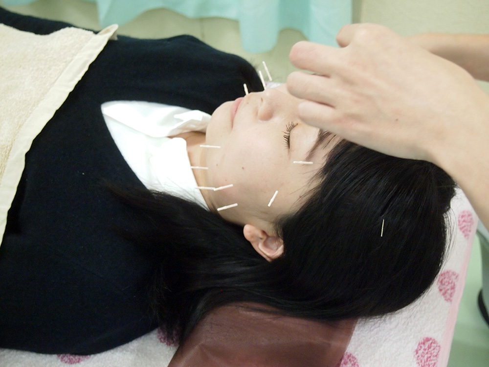 川崎の指圧・美容鍼ならイスクラ鍼灸指圧接骨院